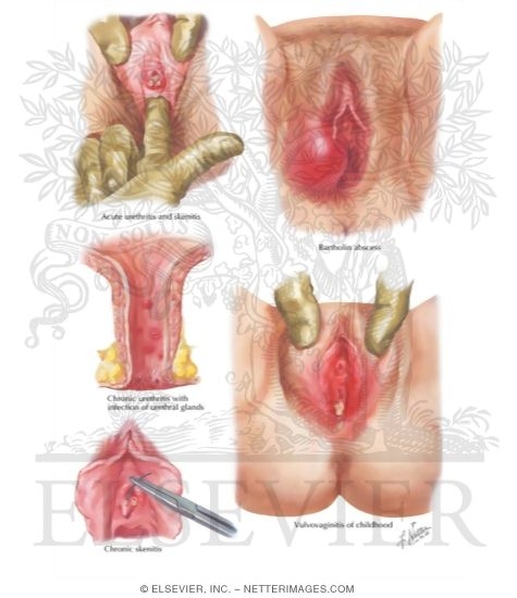 Zara pornosiga hayron boling