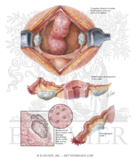 Watermarked preview of labeled image: Congenital Anomalies I - Absence, Rudiments