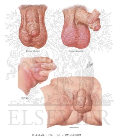Dermatoses I Chemical and Infectious Origin