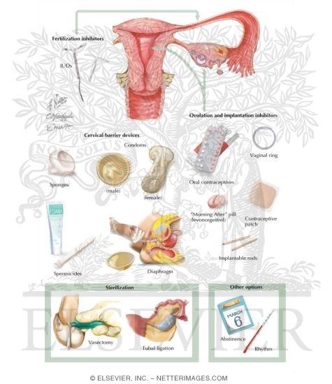 Watermarked preview of labeled image: Contraception