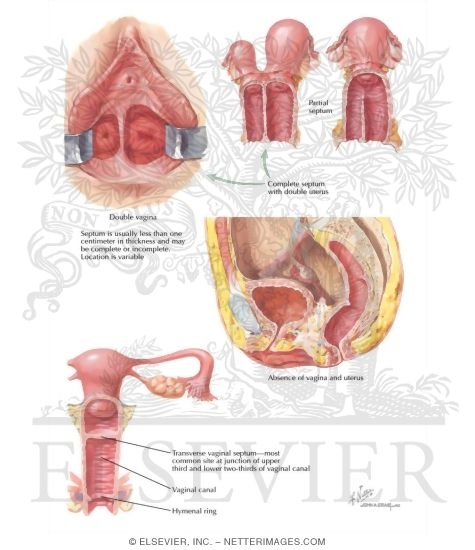 Congenital Anomalies