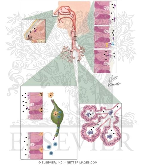 Watermarked preview of unlabeled image: Pulmonary Immunology: Lymphocytes, Mast Cells, Eosinophils, and Neutrophils
