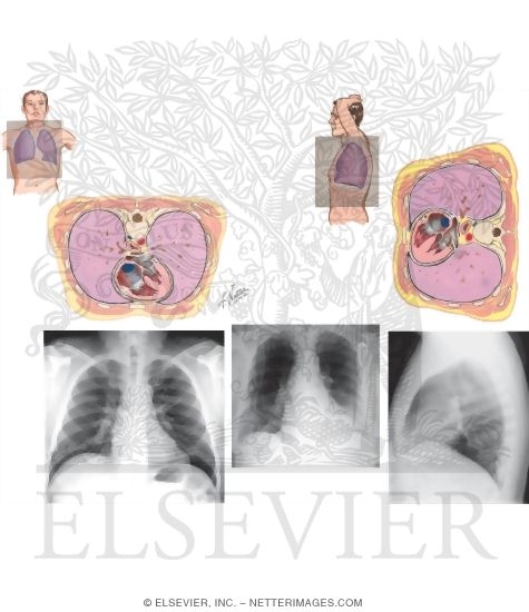 Watermarked preview of unlabeled image: Radiologic Examination of the Lungs