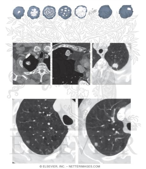 Watermarked preview of unlabeled image: Radiologic Examination of the Lungs