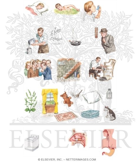 Watermarked preview of unlabeled image: Bronchial Asthma