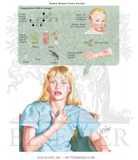 Watermarked preview of labeled image: Extrinsic Allergic Asthma: Clinical Features