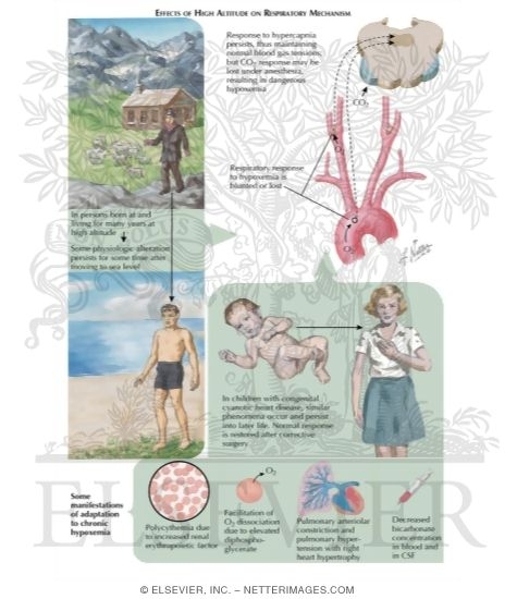 Watermarked preview of labeled image: Effects of High Altitude on Respiratory Mechanism