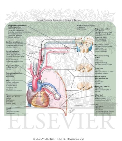 Watermarked preview of labeled image: Sites of Pathologic Disturbances in Control of Breathing