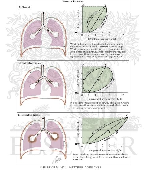 Watermarked preview of labeled image: Work of Breathing