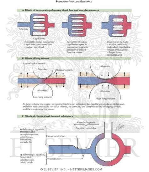Watermarked preview of labeled image: Pulmonary Vascular Resistance