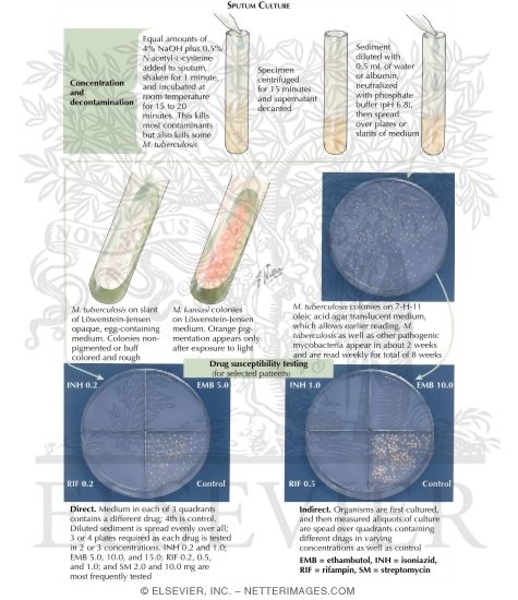 Watermarked preview of labeled image: Sputum Culture