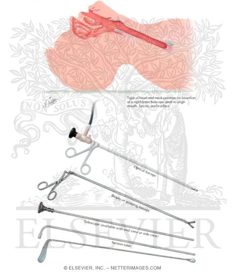 Watermarked preview of labeled image: Rigid Bronchoscopy