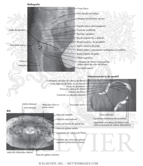 Watermarked preview of labeled image: Hip Radiograph, Arthrogram, MR and PETCT Fusion