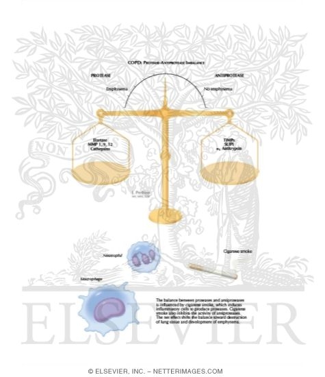 COPD: Protease-Antiprotease Imbalance