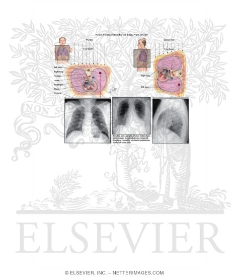 Watermarked preview of labeled image: Radiologic Examination of the Lungs