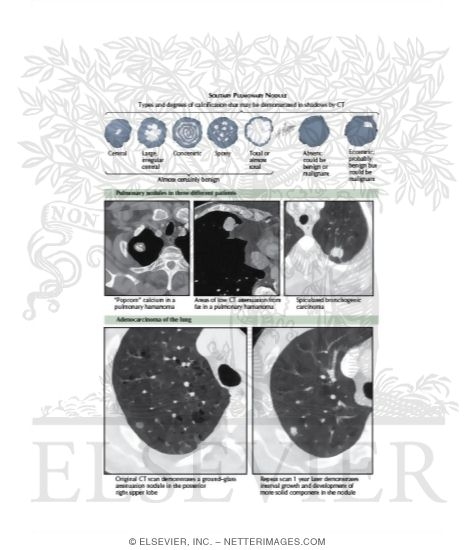 Watermarked preview of labeled image: Radiologic Examination of the Lungs