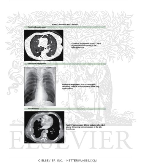 Watermarked preview of labeled image: Radiologic Examination of the Lungs