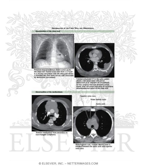 Watermarked preview of labeled image: Radiologic Examination of the Lungs