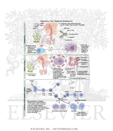Watermarked preview of labeled image: Bronchial Asthma