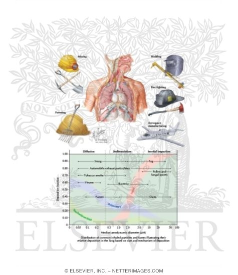 Watermarked preview of labeled image: Overview of Inhalation Diseases