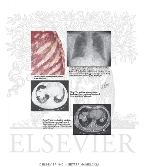 Asbestos dissertation 08 image