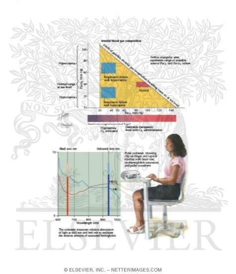 Watermarked preview of labeled image: Oxygen Therapy In Acute Respiratory Failure