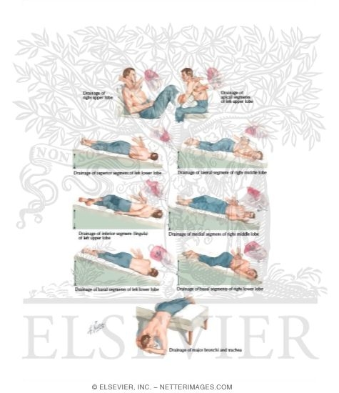 Postural Drainage and Breathing Exercises