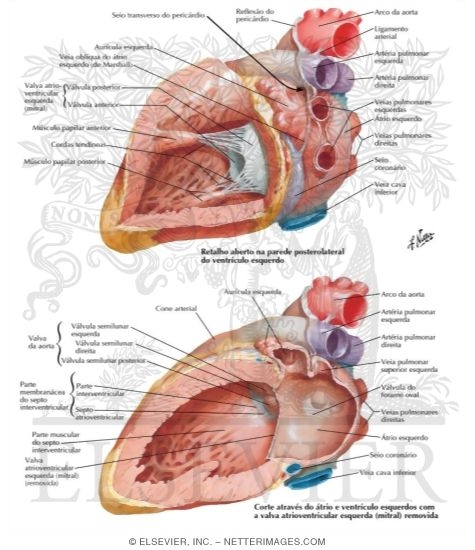 Watermarked preview of labeled image: Left Atrium and Left Ventricle