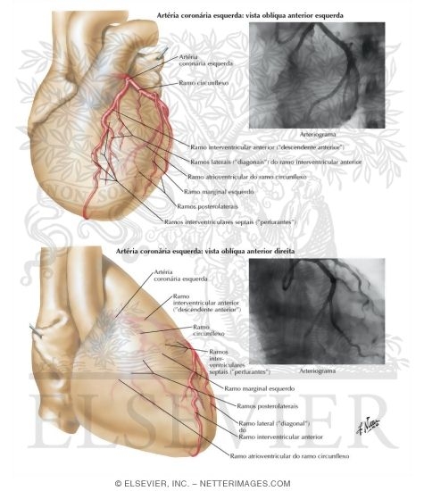 Watermarked preview of labeled image: Selective Cine Coronary Arteriography