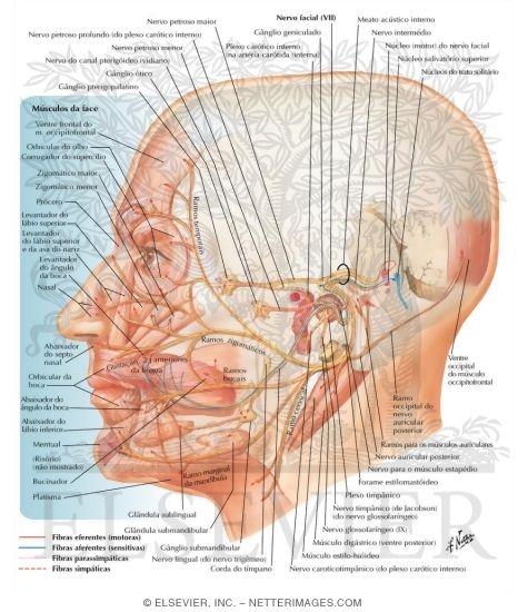 Watermarked preview of labeled image: Facial nerve (VII)