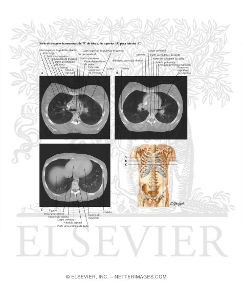 Chest Scans: Axial CT Images