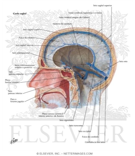 Dural Venous Sinuses