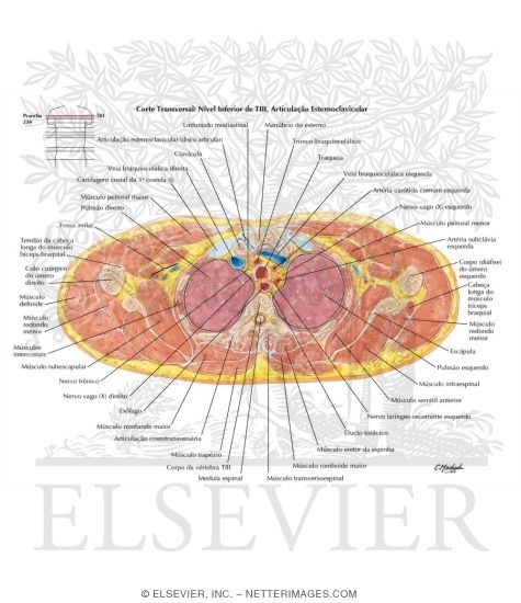 Thorax: Brachiocephalic Vessels