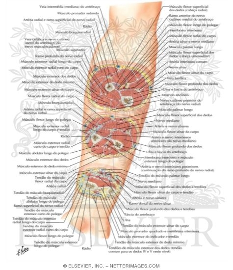 Watermarked preview of labeled image: Cross-Sectional Anatomy of Right Forearm 