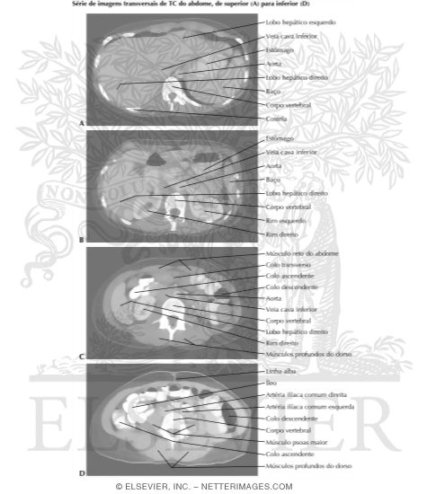 Abdominal Scans: Axial CT Images