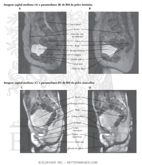 Watermarked preview of labeled image: Pelvic Scans: Sagittal MR Images