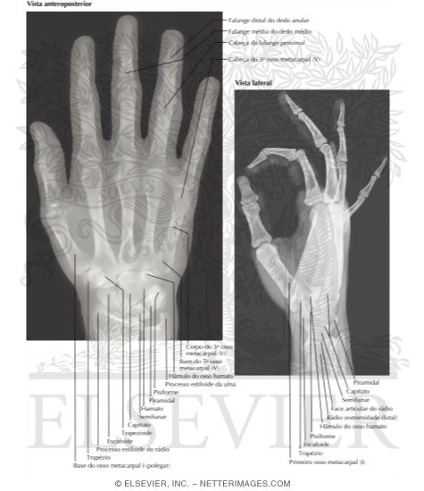 Watermarked preview of labeled image: Wrist: Radiographs   