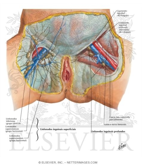 Lymph Vessels and Nodes of Perineum: Female