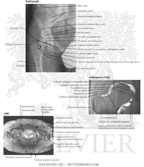 Watermarked preview of labeled image: Hip Radiograph, Arthrogram, MR and PETCT Fusion