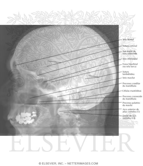 Skull: Lateral Radiograph