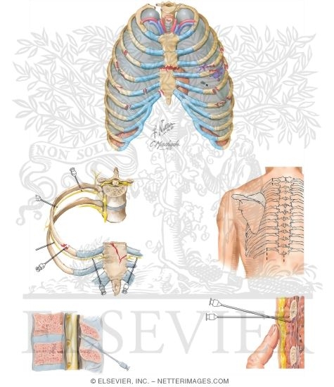 Rib and Sternal Fractures