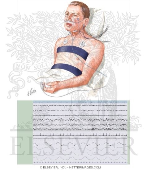 Watermarked preview of unlabeled image: Sleep Medicine