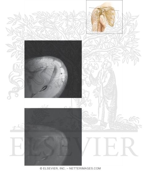 Watermarked preview of unlabeled image: Cross Section of the Shoulder: Axial View