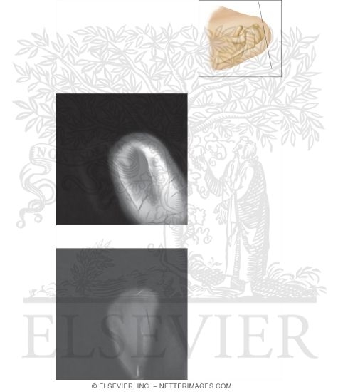 Watermarked preview of unlabeled image: Cross Section of the Shoulder: Sagittal Section