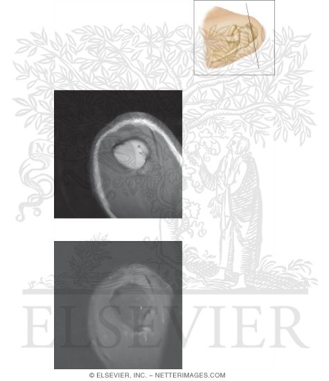 Watermarked preview of unlabeled image: Cross Section of the Shoulder: Sagittal Section