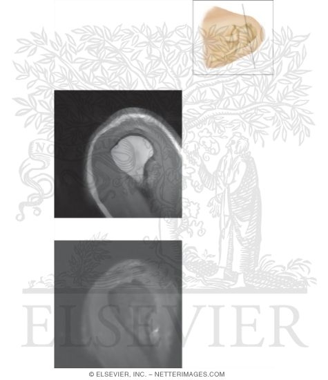 Watermarked preview of unlabeled image: Cross Section of the Shoulder: Sagittal Section