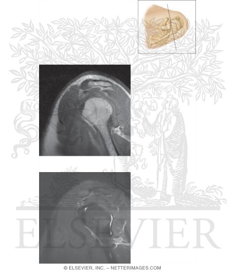Watermarked preview of unlabeled image: Cross Section of the Shoulder: Sagittal View