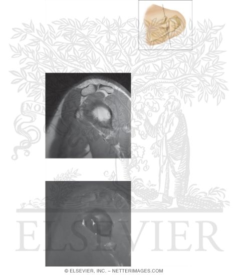 Watermarked preview of unlabeled image: Cross Section of the Shoulder: Sagittal View
