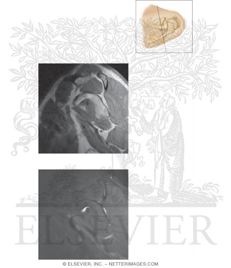 Watermarked preview of unlabeled image: Cross Section of the Shoulder: Sagittal View