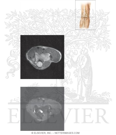 Watermarked preview of unlabeled image: Cross Section of the Elbow: Axial View